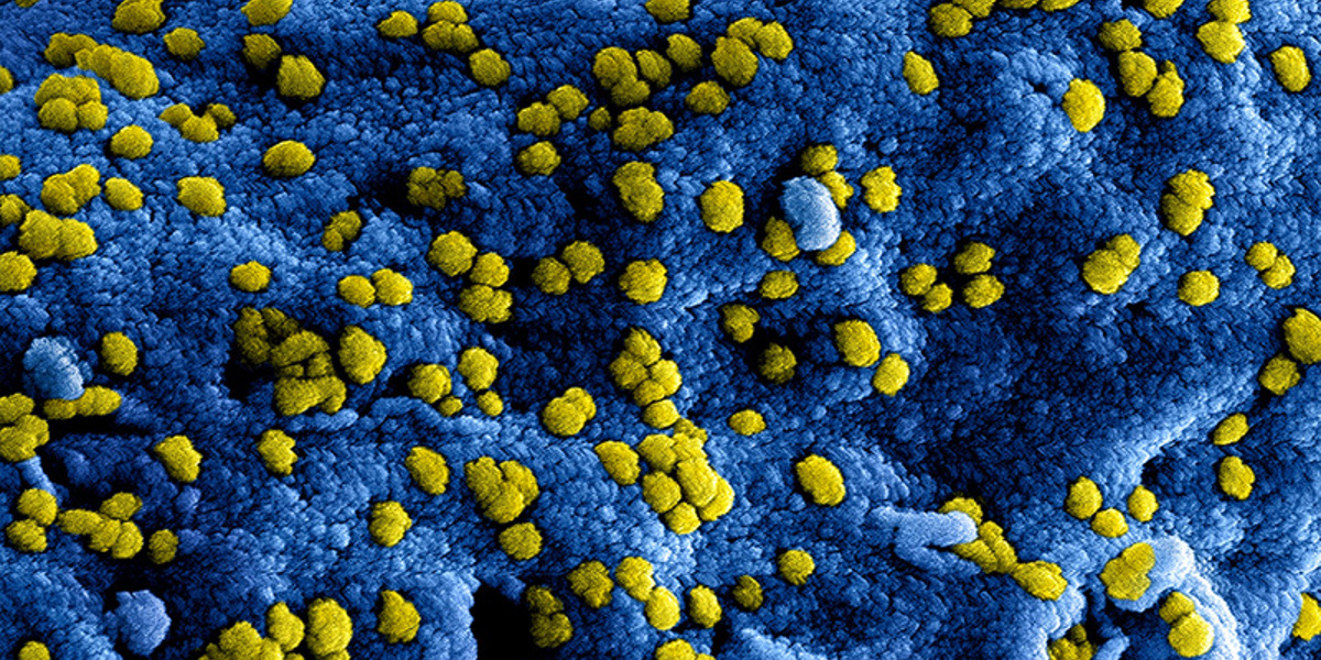 Vragen over het coronavirus en sport